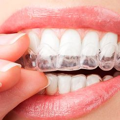 Clínica Dental Quintás dientes blancos